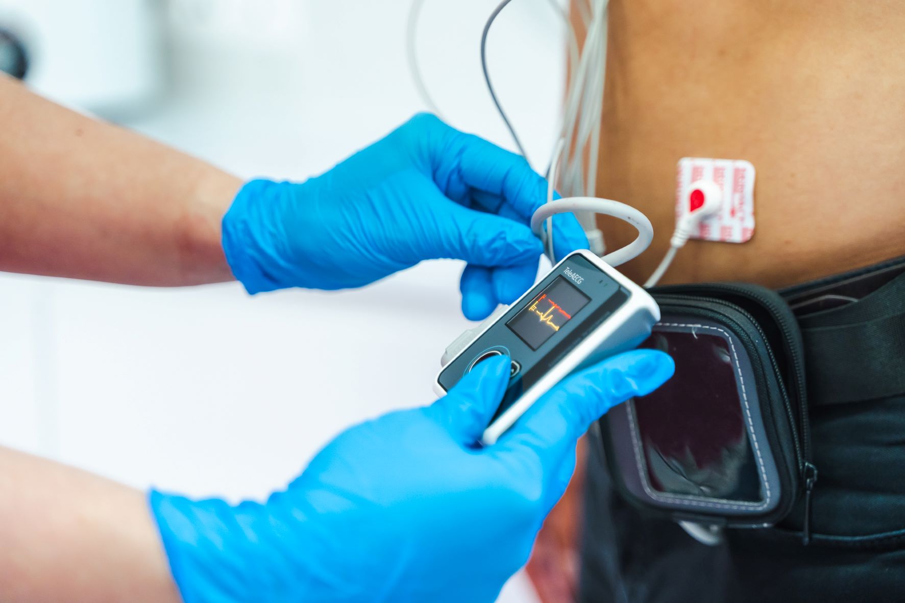 Holter Ekg Poznań Neomedica Umów Się Już Dziś 1048