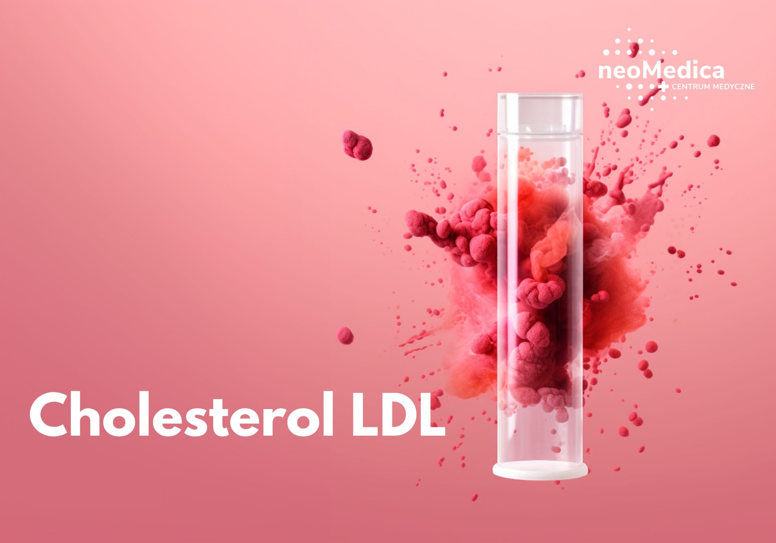 Badanie Cholesterol Ldl Poznań Neomedica Kup Online Ze Zniżką 2248